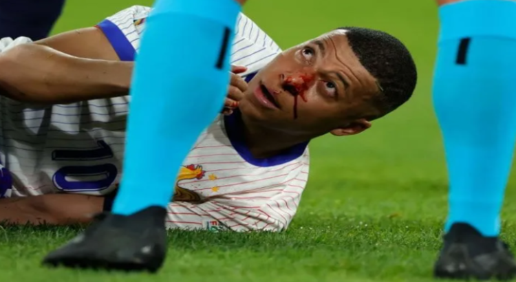 Kylian Mbappé jugará con máscara en la Eurocopa 2024; no será operado tras su fractura de nariz